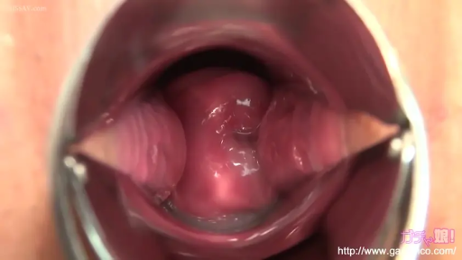 诊室 · 仰卧位 · 扩阴器 · 妇科检查 · 内景特写 · 医疗视角