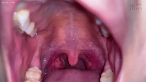 室内 · 张口 · 内部视角 · 展示口腔 · 张大嘴 · 咽喉特写