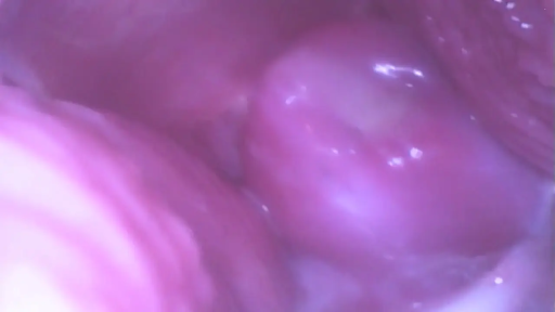 观察 · 不适用 · 不适用 · 器官特写 · 内窥镜 · 粉色 · 人体内部