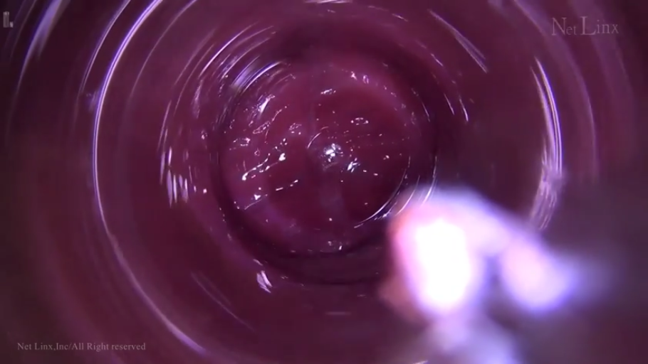 Indoor · 第一视角 · Fully nude · 检查 · 内窥镜 · 子宫颈特写