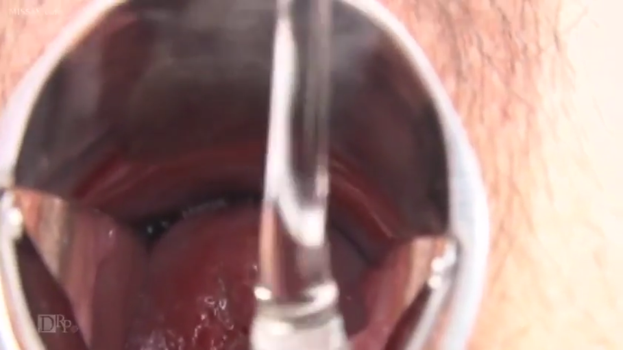 室内 · 全裸 · 张开双腿 · 阴道特写 · 扩阴器 · 妇科检查 · 医疗Play