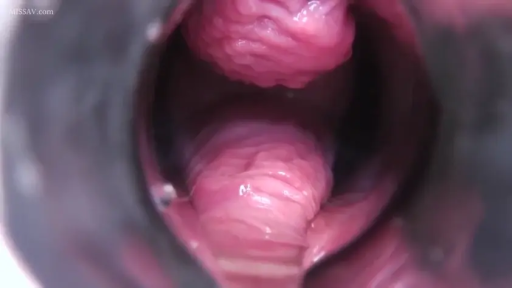 室内 · 全裸 · 仰卧 · 第一人称视角 · 窥阴器 · 阴道内景 · 窥镜检查