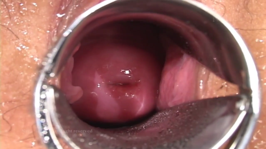 室内 · 全裸 · 仰卧 · 检查 · 阴道特写 · 扩阴器 · 医疗