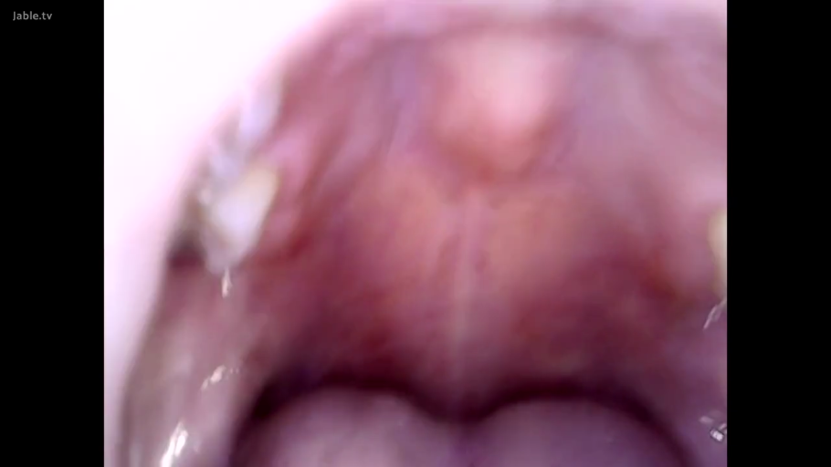 室內 · 口腔特寫