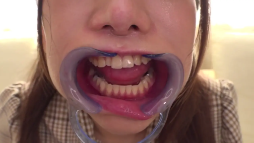 室内 · 口を開け · 正面 · 嘴部特写 · 格纹上衣 · 扩嘴器 · 使用扩嘴器